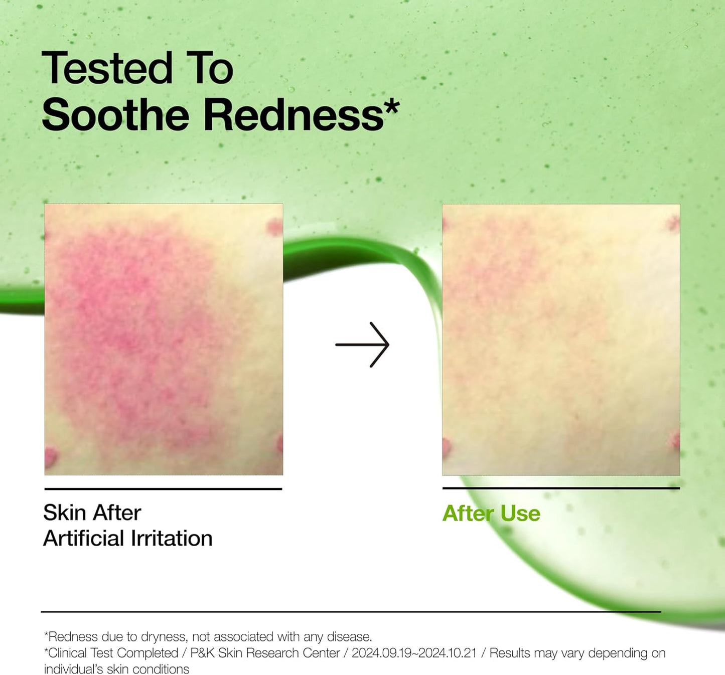 ANUA Azelaic Acid 10% + Hyaluron Redness Soothing Serum