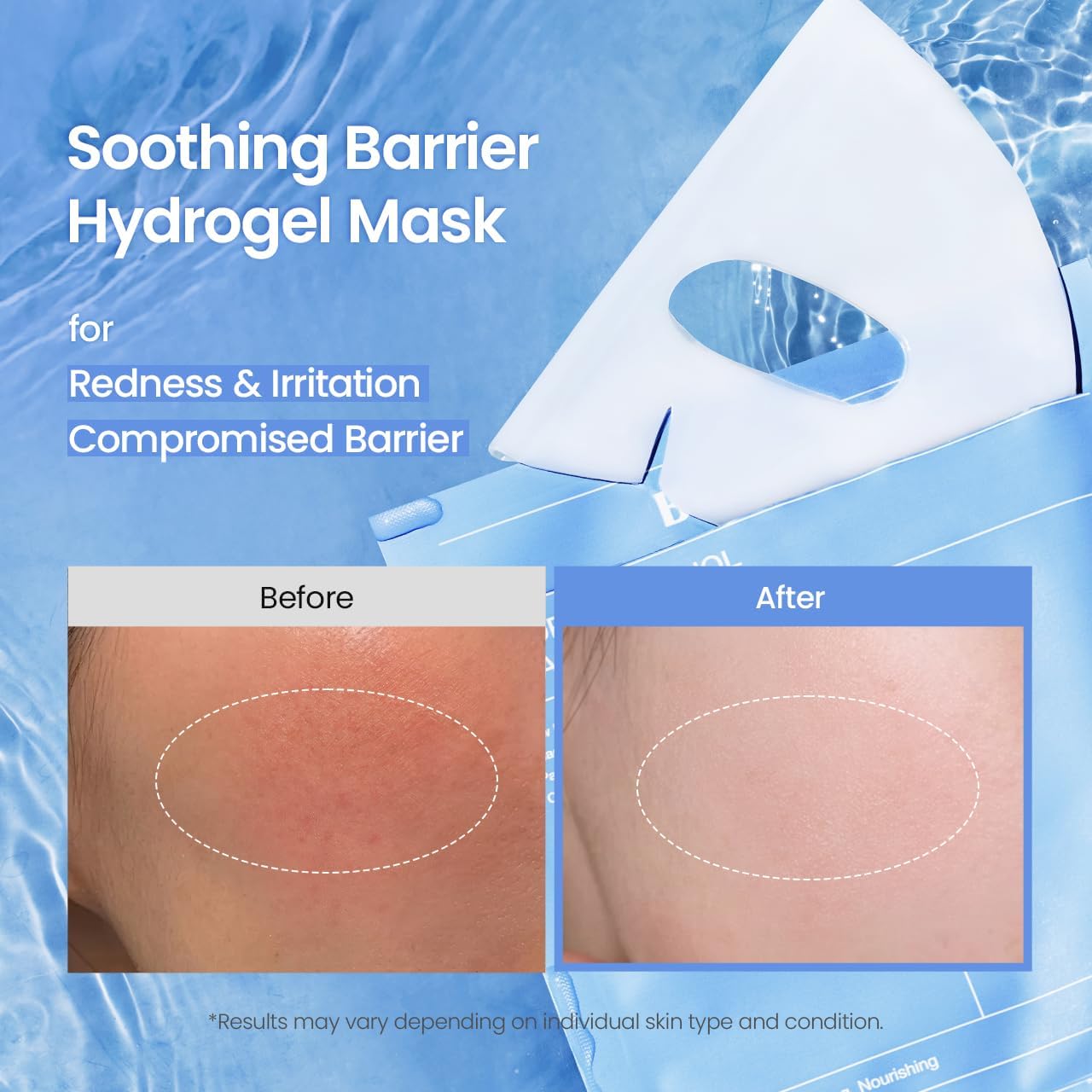 Biodance Hydro Cera‑Nol Real Deep Mask (4 Pieces)